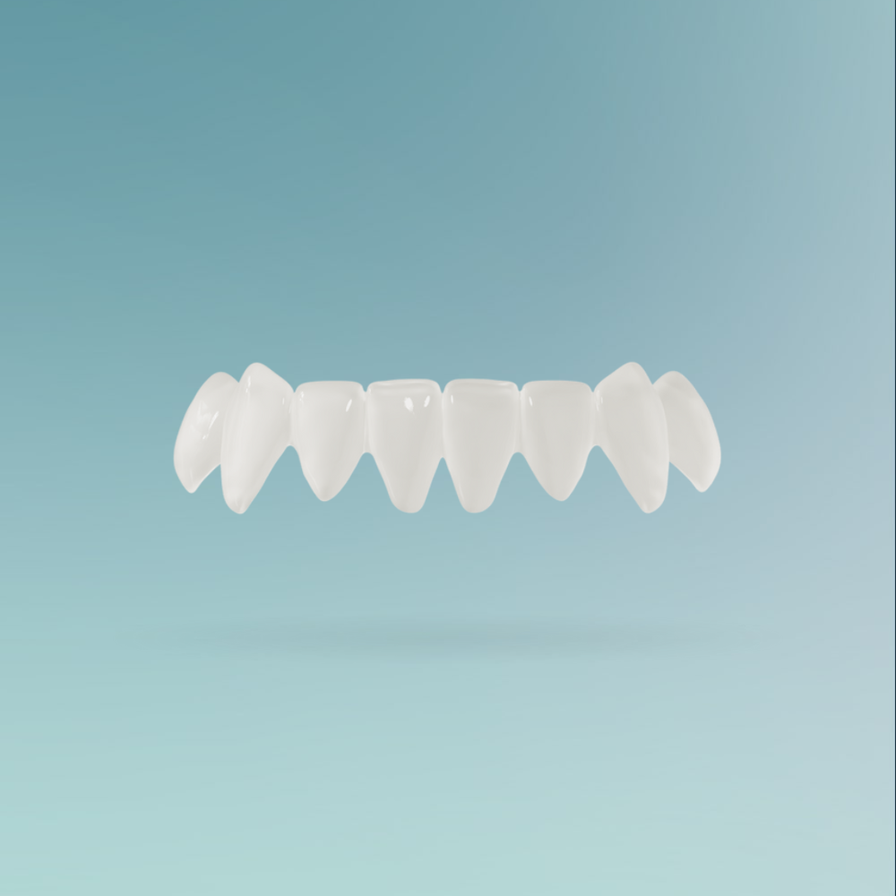 Veneers custom-made