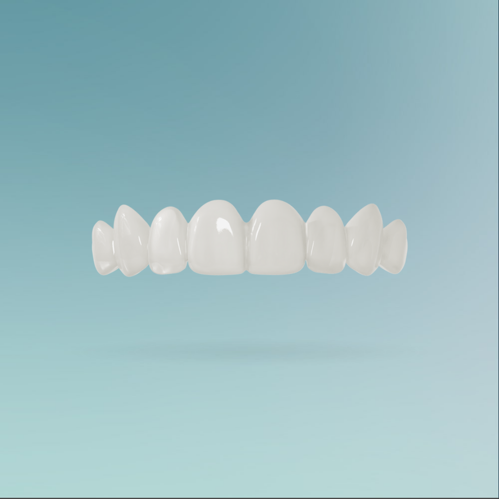 Veneers custom-made