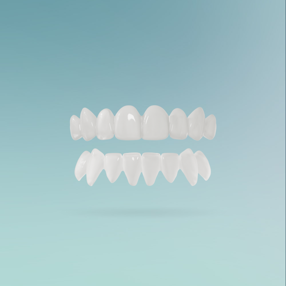 Veneers custom-made