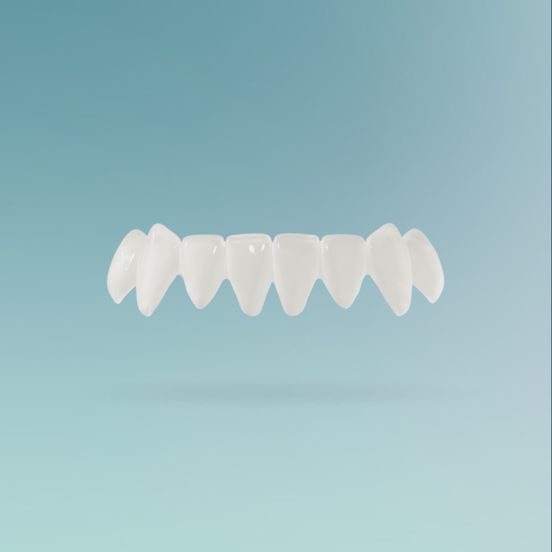 Veneers custom-made