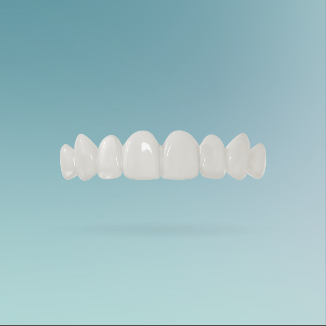 Veneers custom-made
