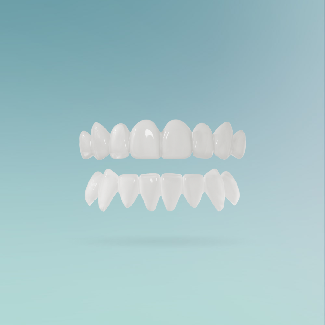 Veneers custom-made