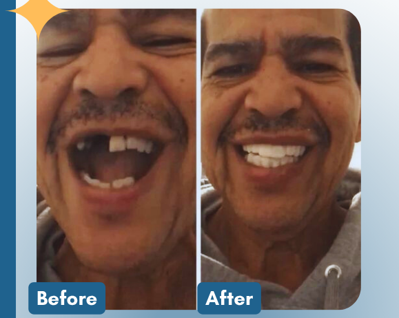 A confident smile, restored in minutes.